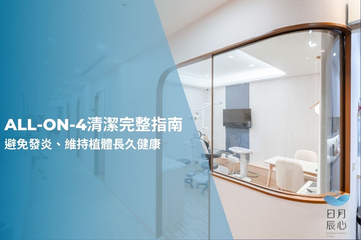 All-on-4清潔完整指南｜避免發炎、維持植體長久健康