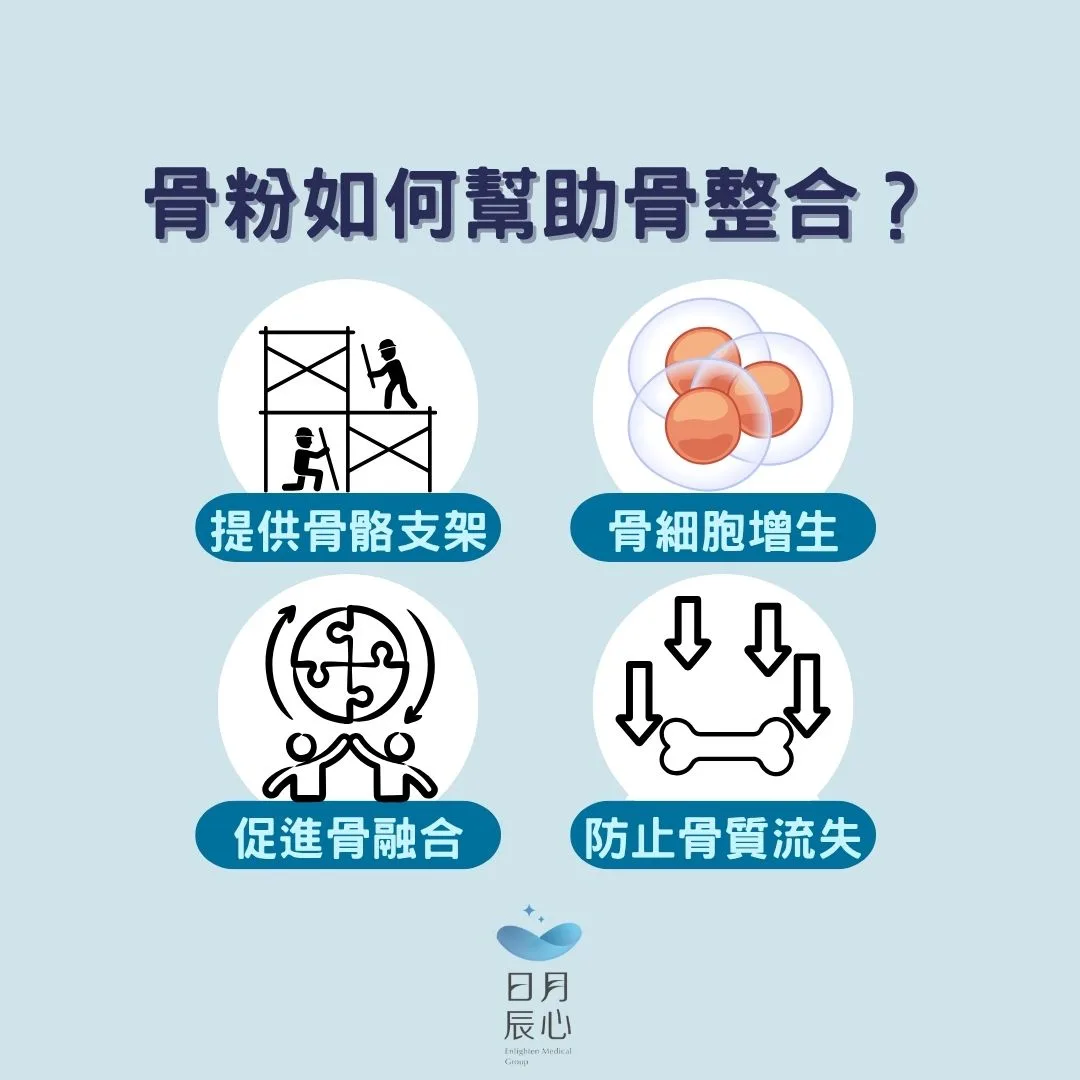 植牙骨粉知多少?牙科專家全面解析植牙補骨粉大小事 1 骨粉如何幫助骨整合