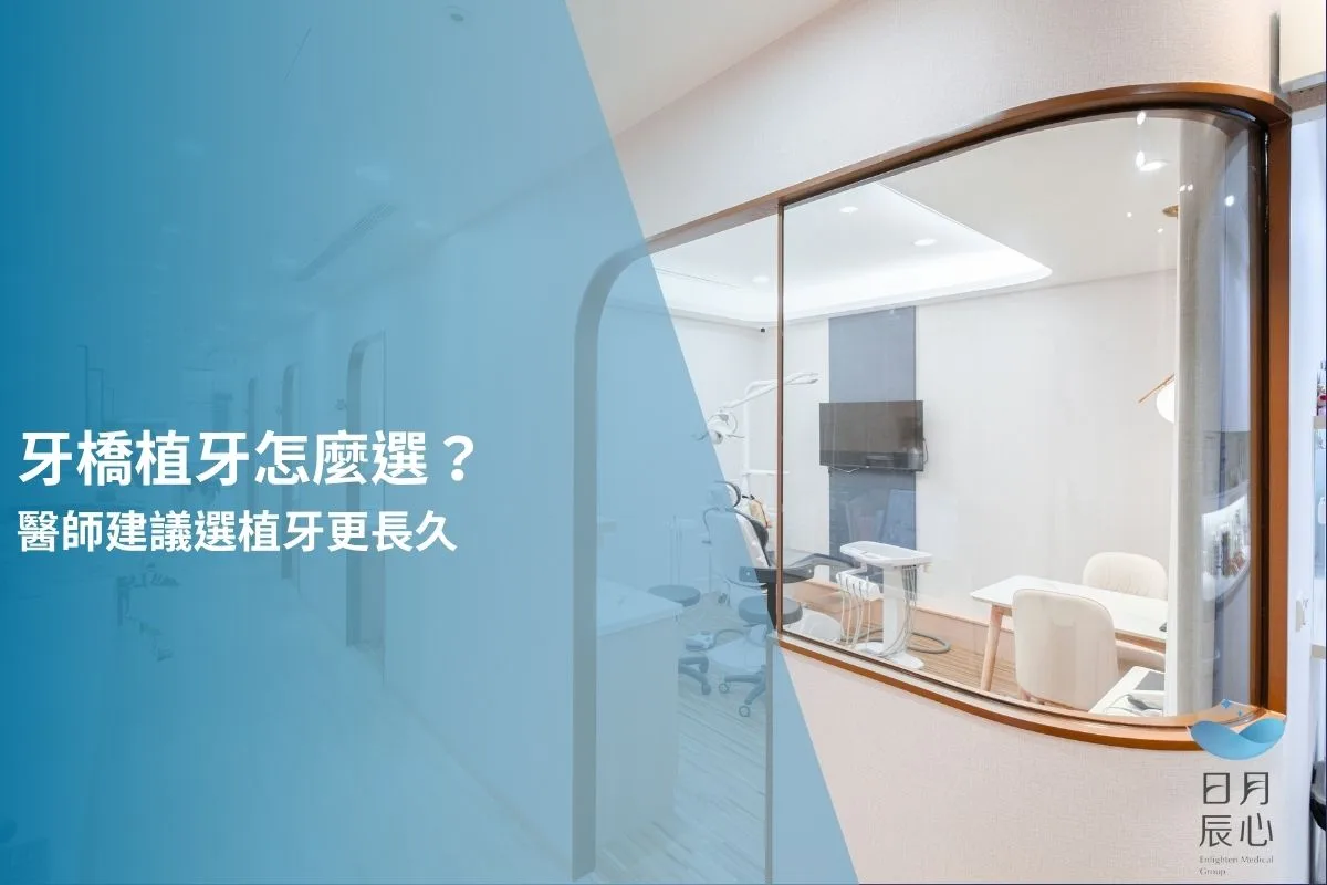 牙橋植牙怎麼選？醫師建議選植牙更長久