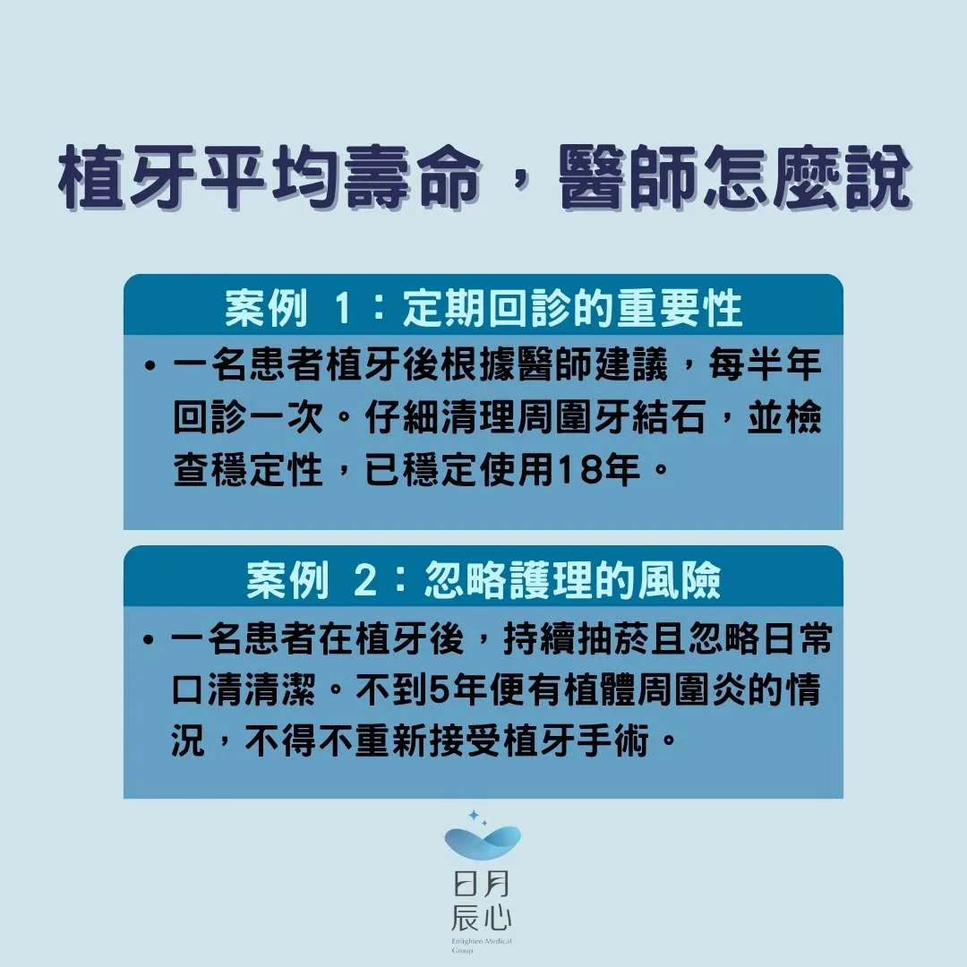 植牙平均壽命，醫師怎麼說