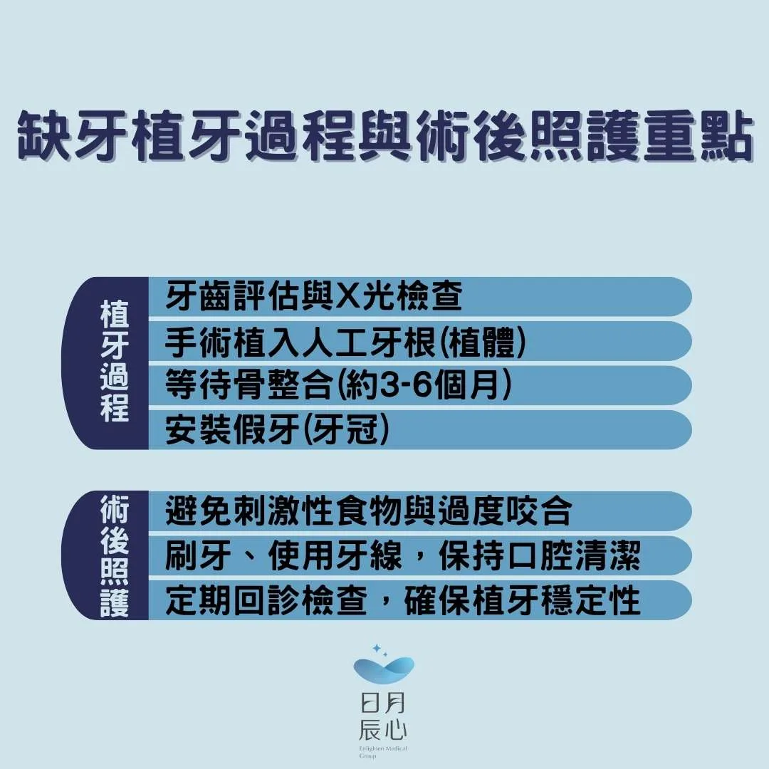 缺牙植牙過繩與術後照顧重點