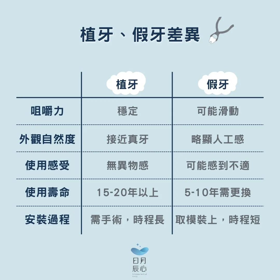植牙假牙差異