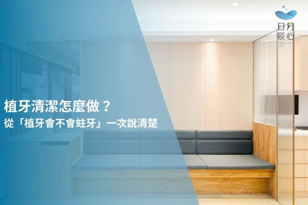 植牙清潔怎麼做？從「植牙會不會蛀牙」一次說清楚