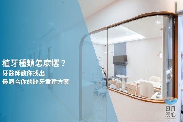 植牙種類怎麼選？牙醫師教你找出最適合你的缺牙重建方案
