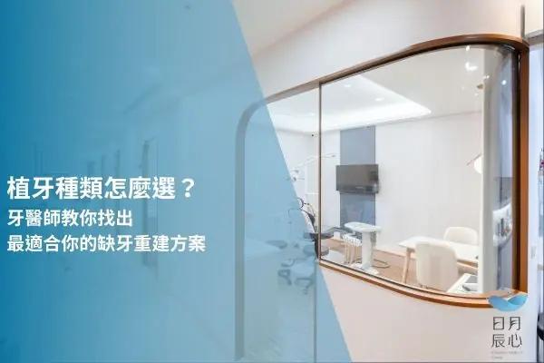 植牙種類怎麼選？牙醫師教你找出最適合你的缺牙重建方案