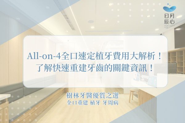 All-on-4全口速定植牙費用大解析！了解快速重建牙齒的關鍵資訊！