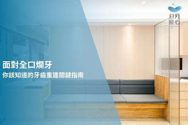 面對全口爛牙，你該知道的牙齒重建關鍵指南