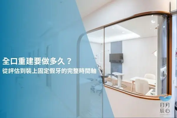全口重建要做多久？從評估到裝上固定假牙的完整時間軸