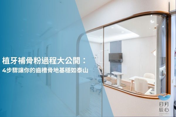 植牙補骨粉過程大公開：4 步驟讓你的齒槽骨地基穩如泰山