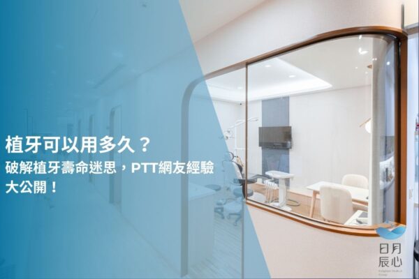 植牙可以用多久？破解植牙壽命迷思，PTT網友經驗大公開！