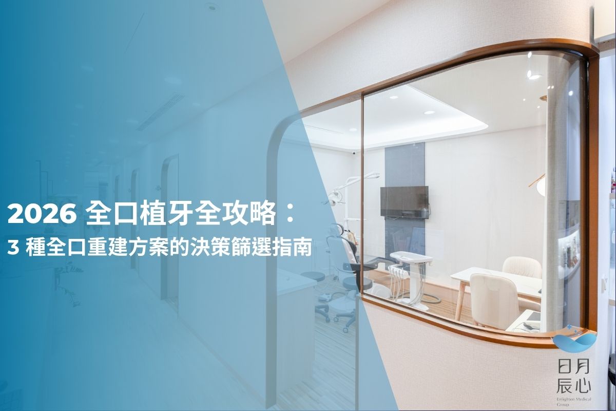 2026 全口植牙全攻略：3 種全口重建方案的決策篩選指南