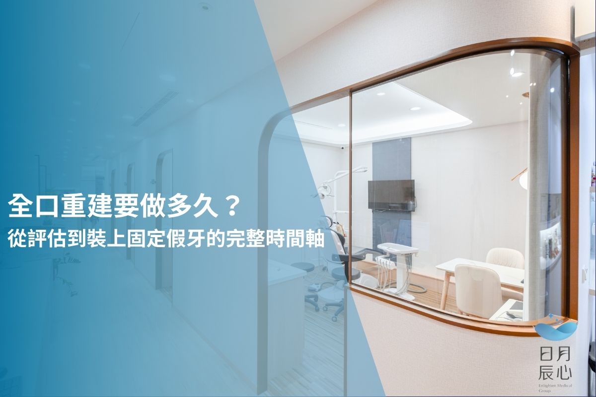 全口重建要做多久？從評估到裝上固定假牙的完整時間軸