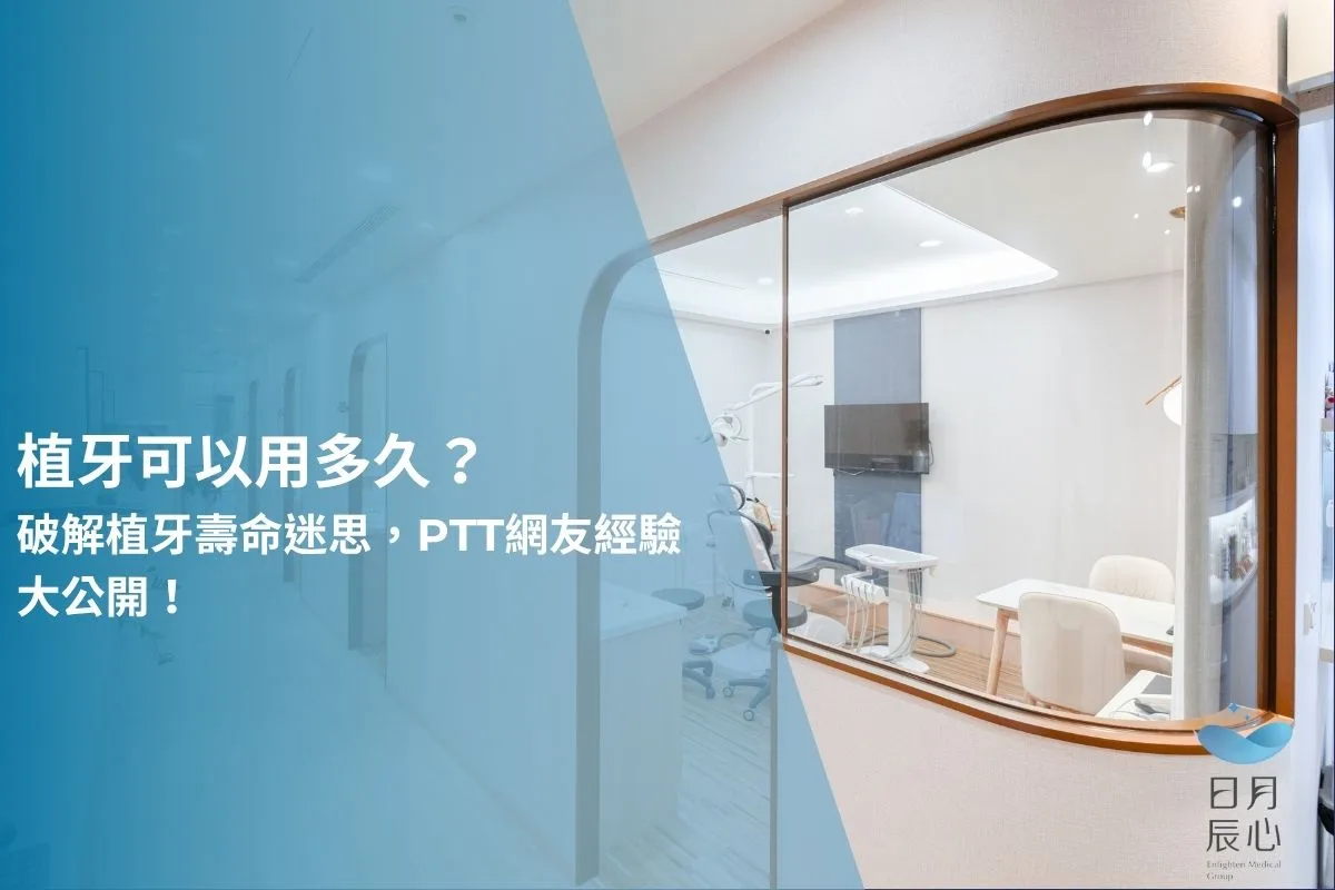 植牙可以用多久？破解植牙壽命迷思，PTT網友經驗大公開！