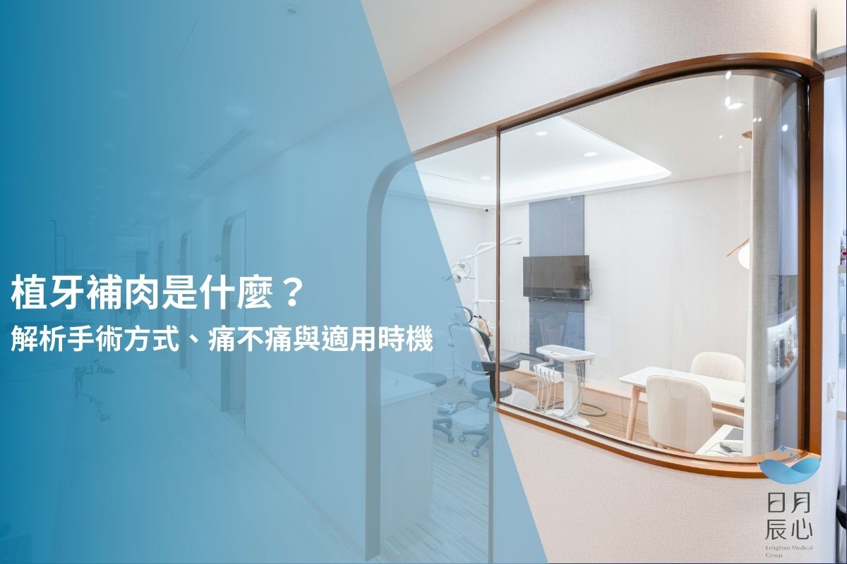 植牙補肉是什麼？解析手術方式、痛不痛與適用時機