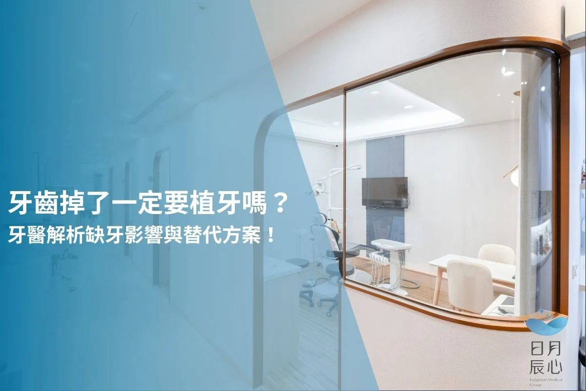 牙齒掉了一定要植牙嗎？牙醫解析缺牙影響與替代方案！