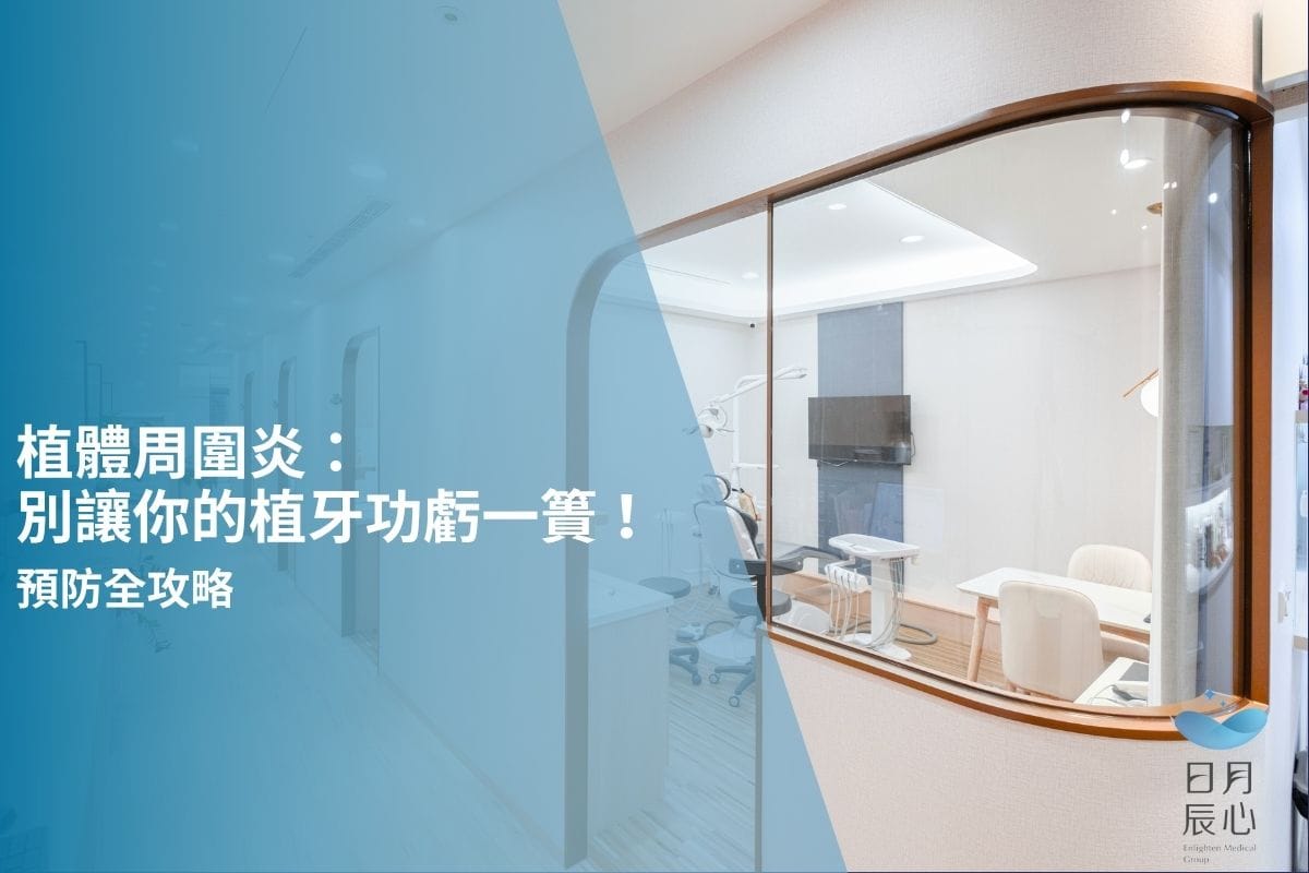 植體周圍炎：別讓你的植牙功虧一簣！與防全攻略