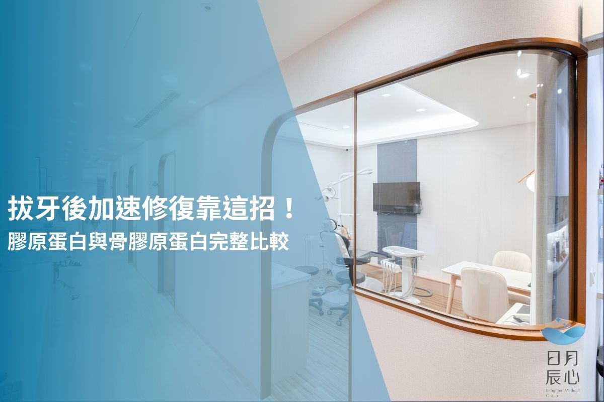 拔牙後加速修復靠這招！膠原蛋白與骨膠原蛋白完整比較