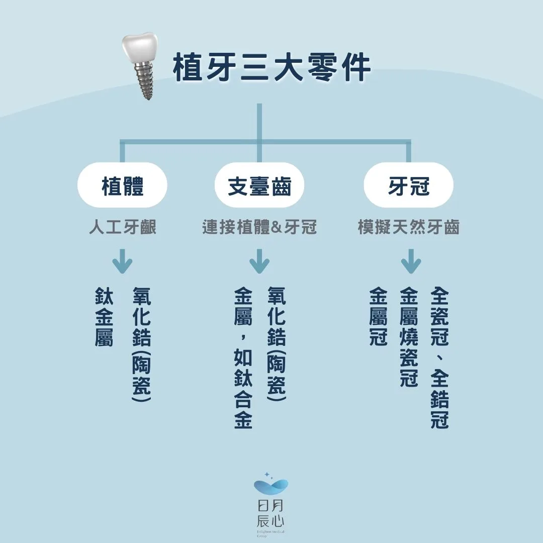 最完整植牙材質分析,植牙材質價格、手術效果綜合評比大公開 1 植牙三大零件
