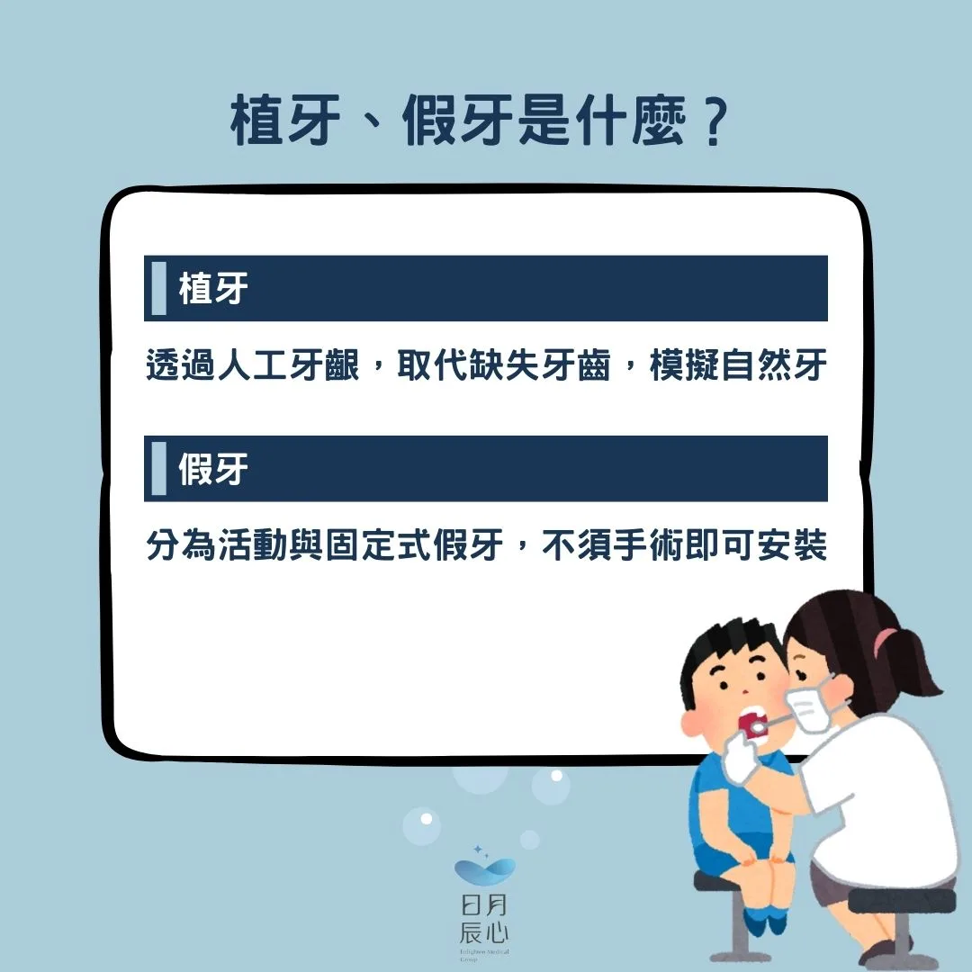 植牙假牙是什麼
